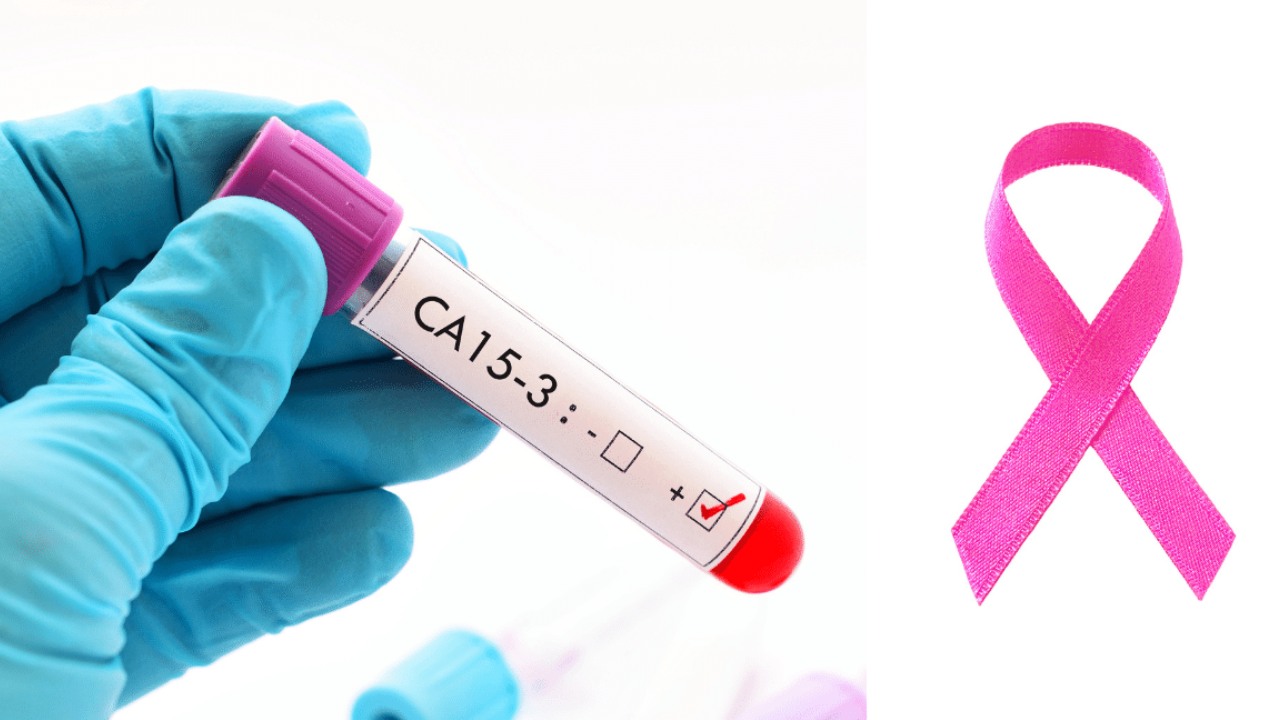 Những Hiểu Lầm Về Phương Pháp Tầm Soát Các Bệnh Lý Tuyến Vú